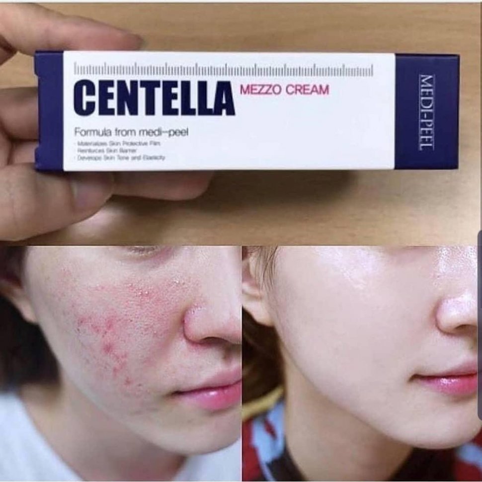 Medi-Peel Centella Mezzo Cream (30ml) Успокаивающий крем с экстрактом центеллы